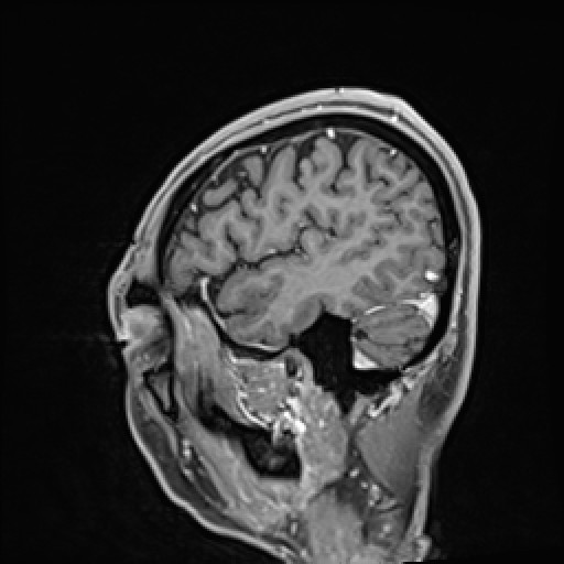 Click on the Serie image to view the images of VILLANUEVA, WILLIAM A.